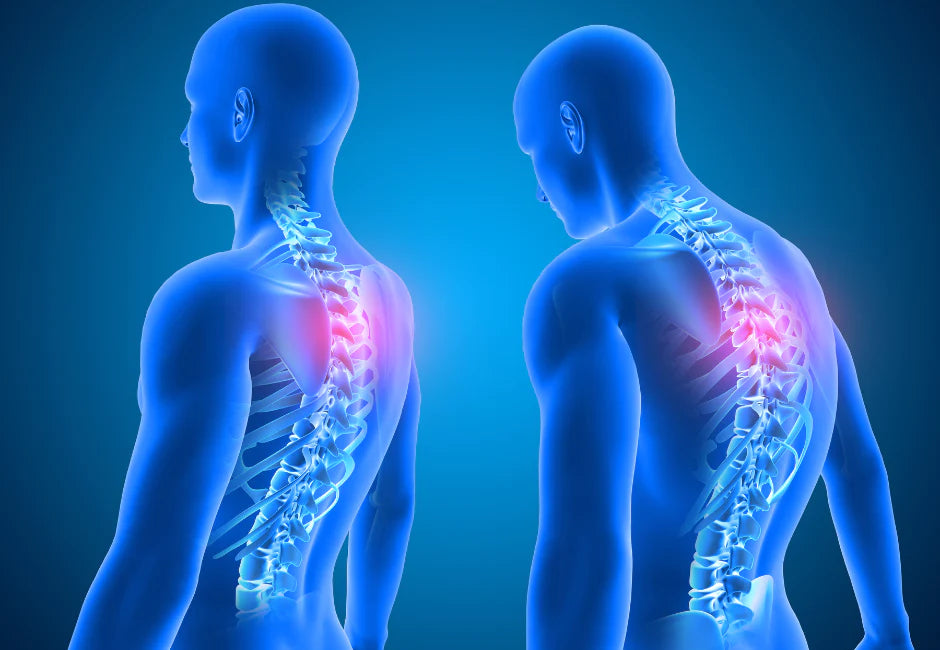 How Does Posture Affect Your Well-Being?